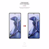 Плівка захисна Armorstandart Matte Xiaomi 11T (ARM61176) - Image 3