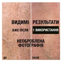 Лосьйон для тіла Neutrogena Інтенсивне відновлення 250 мл (3574660533286/3574661751603) - 6