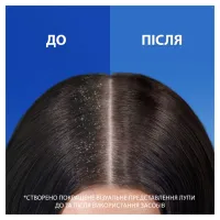 Шампунь Head & Shoulders Свіжість ментолу Проти лупи 400 мл (5011321336094) - 4