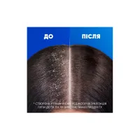 Шампунь Head & Shoulders Для чутливої шкіри 400 мл (5011321336124) - 5