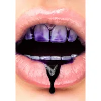 Засіб для відбілювання зубів SmileKit V34 Коректор кольору зубів 30 мл (5.3010) - 10