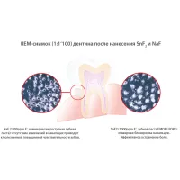 Зубна паста Dr. Wild Emofluor Daily Care зі стабілізованим фторидом олова 75 мл (7611841701686) - 4