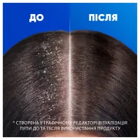 Шампунь Head & Shoulders Глибоке зволоження 400 мл (8001841406688) - 5