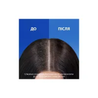 Шампунь Head & Shoulders Проти лупи Цитрусова свіжість 800 мл (8700216156172) - 3