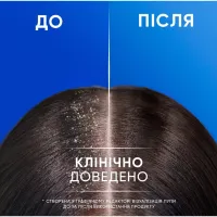 Шампунь Head & Shoulders 2 в 1 Проти лупи Яблучна свіжість 330 мл (8700216304689) - 6