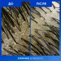 Шампунь Head & Shoulders Clarify & Shine Проти лупи Очищення та блиск 400 мл (8700216658461) - 7