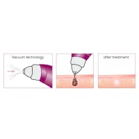 Прилад для чищення шкіри обличчя Beurer FC 41 - Зображення 7